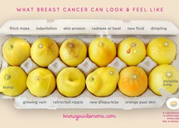 Photo: Knowyourlemons