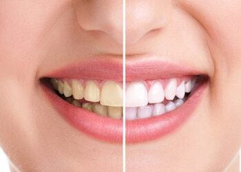 Orthodontistemontreal
