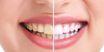 Orthodontistemontreal