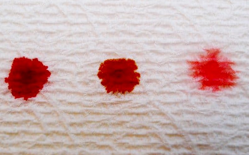 Your Implantation Bleeding For Period. light bleeding before and after peri...