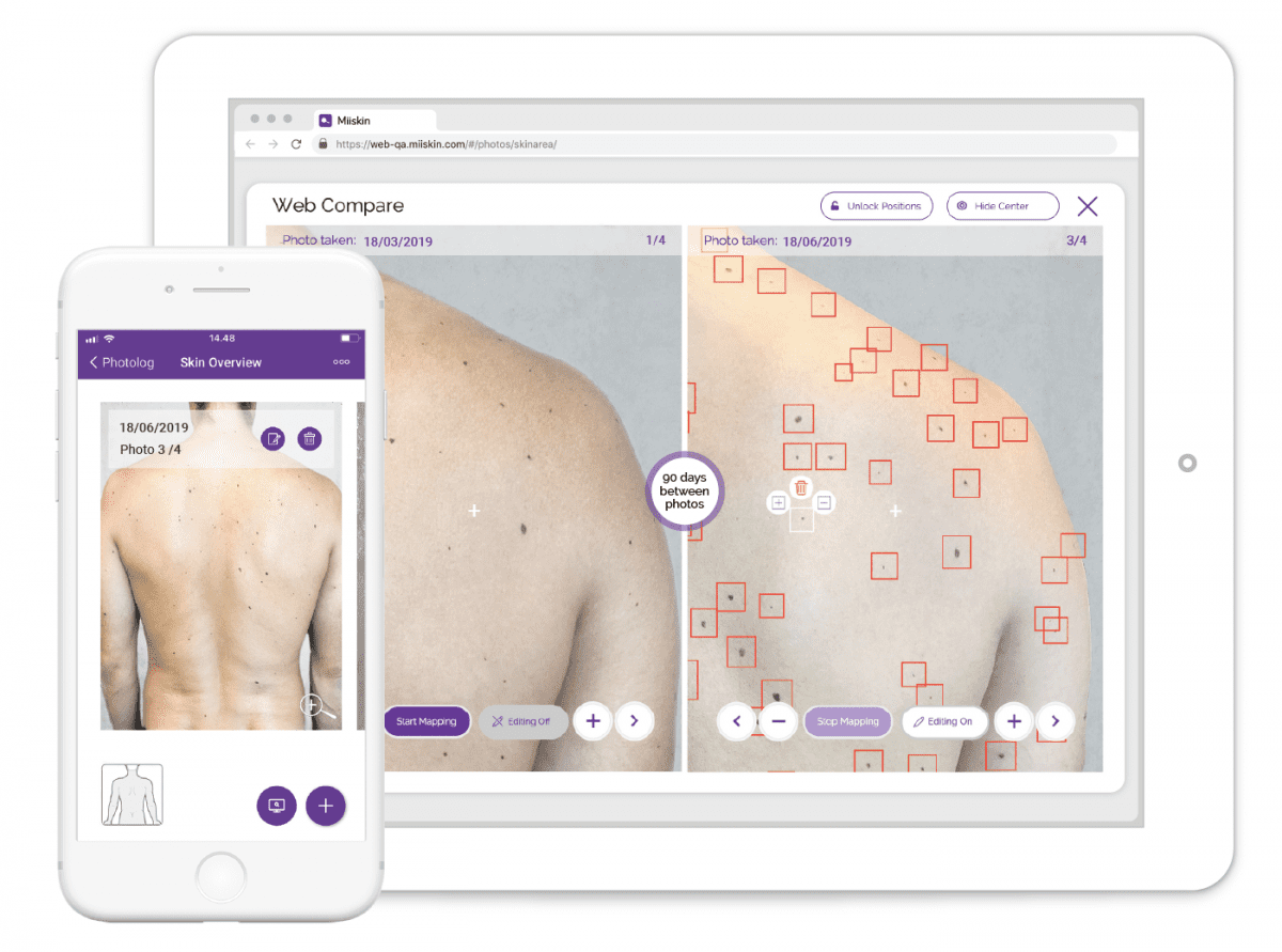 https blogs images.forbes.com leebelltech files 2019 06 Skin Mapping 1200x891 1