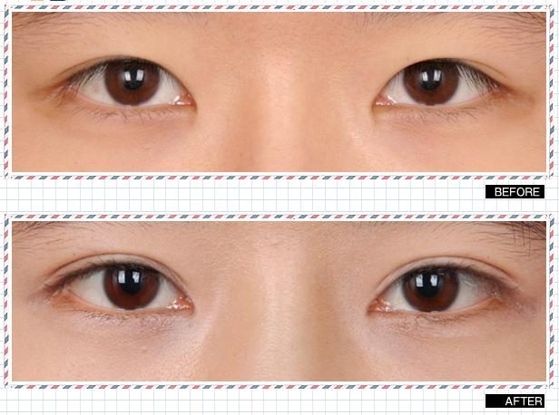 Double eyelid tape vs hot sale glue