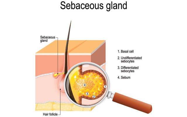 sebaceous